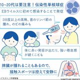 伝染性単核球症、10～20代は要注意　長引くだるさ、疲労感…