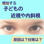 増加する子どもの近視、内斜視　原因はスマホ？対策は？　国際医療福祉大の…